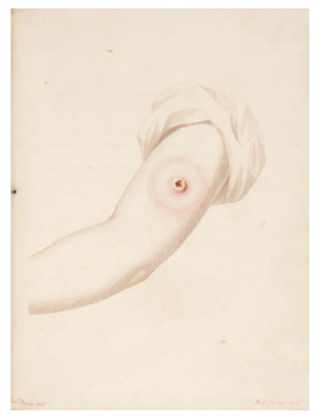knee